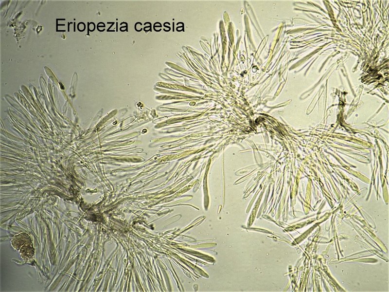 Eriopezia caesia-amf148.jpg-micro.jpg - Eriopezia caesia ; Syn1: Peziza caesia ; Syn2: Lachnella caesia